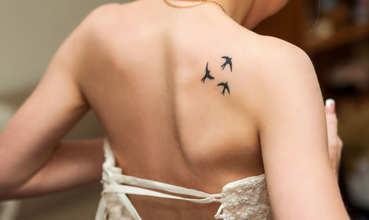 Hirurško uklanjanje tetovaža