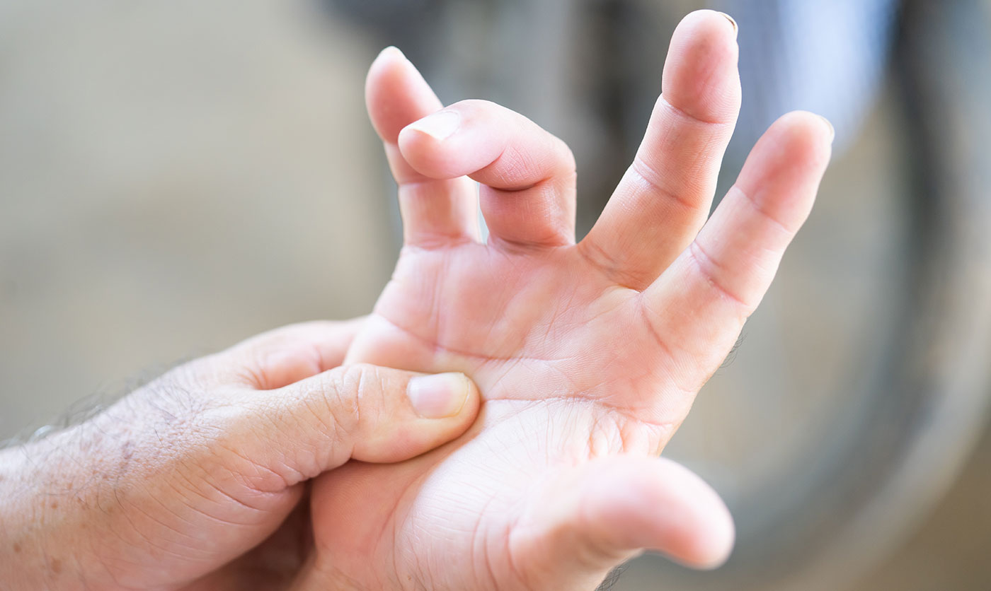 Stenozantni tendovaginitis – škljocajući prst – trigger finger